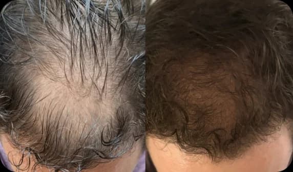 Before and after results
