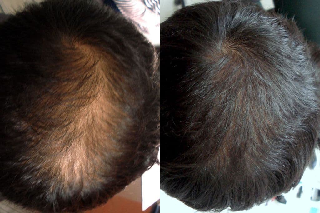Before and after results