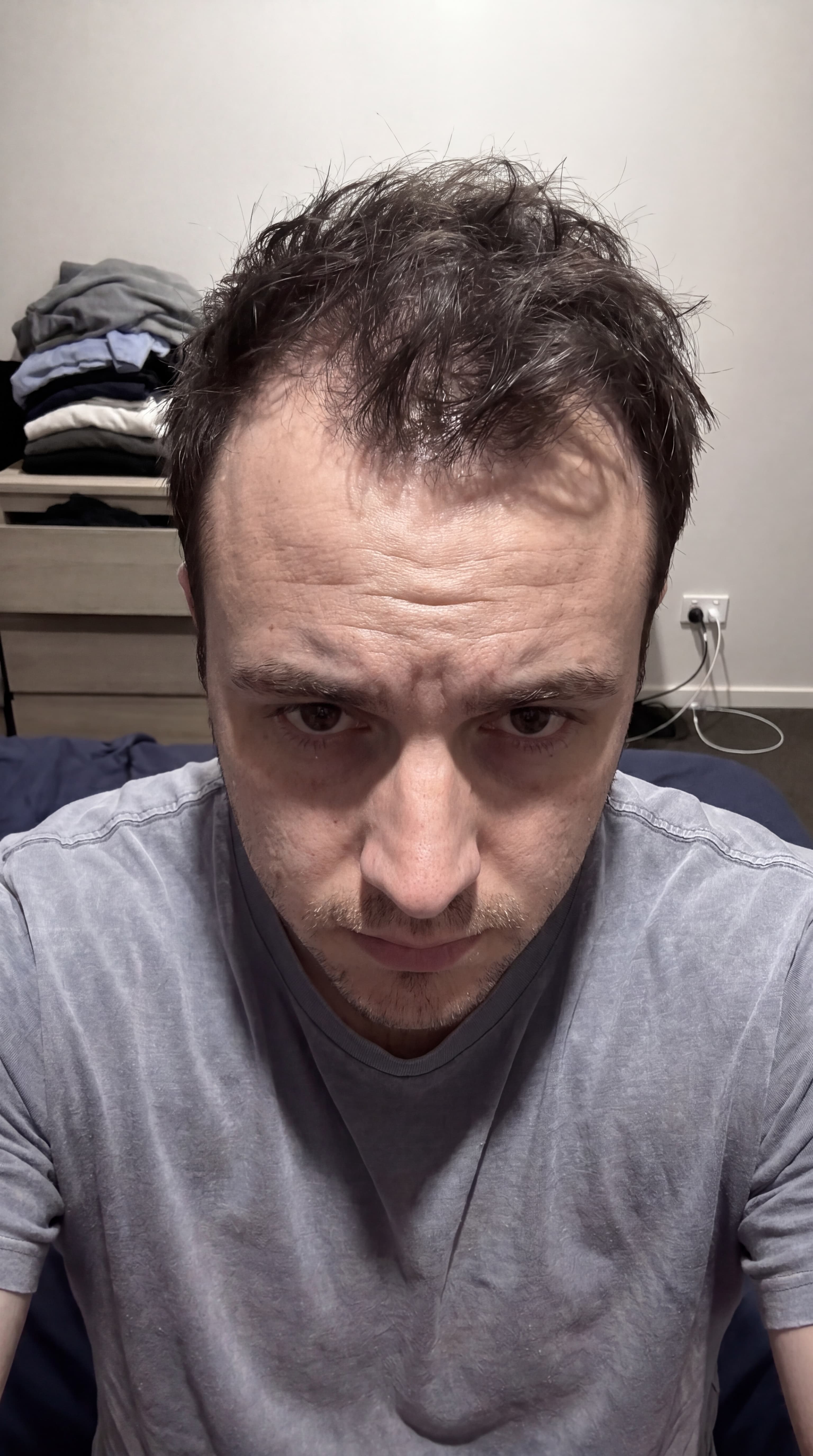 Man noticing early hair thinning